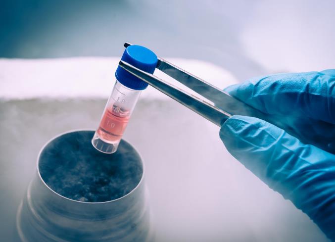 冻存提取 冻存提取